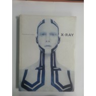 X-RAY